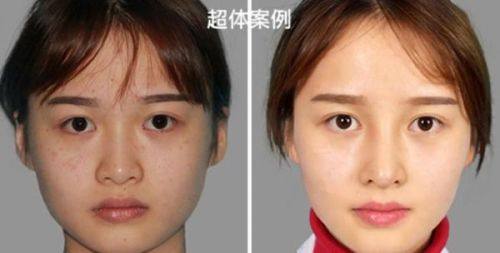 宁东旭医生口碑评价：