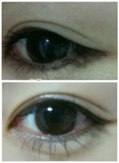 深圳博美整形医院怎么样