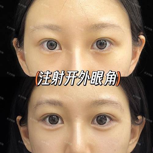 庄河飞燕整形医院医生名单及擅长领域：