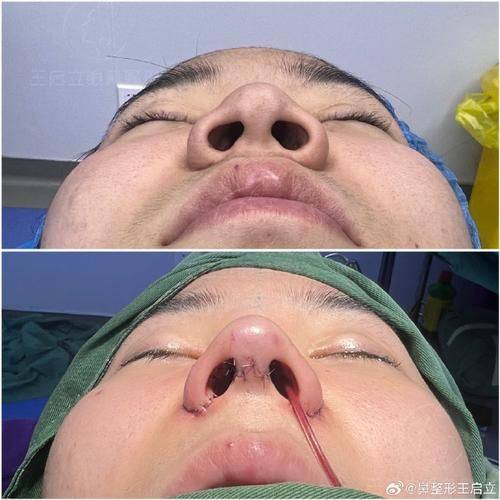 成都臻瑞阿芙罗医疗美容诊所医生名单及擅长领域：