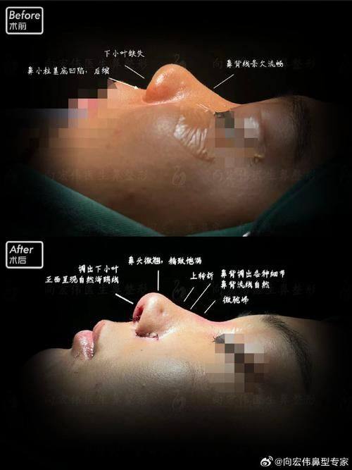 成都臻瑞阿芙罗医疗美容诊所口碑评价：