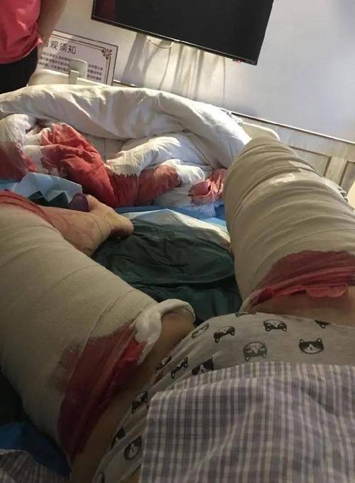 宁东旭医生擅长领域：