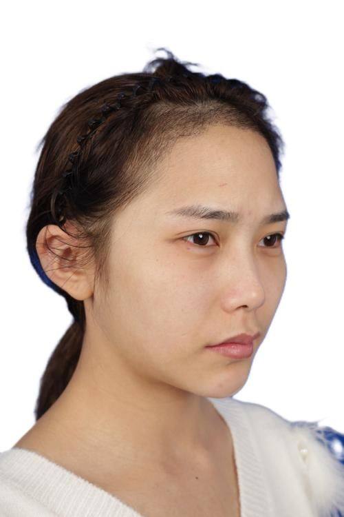 深圳博美整形医院擅长项目