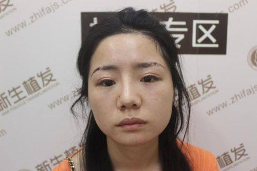 陈志芳医生怎么预约？