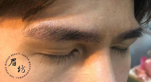 庄河飞燕整形医院擅长项目：