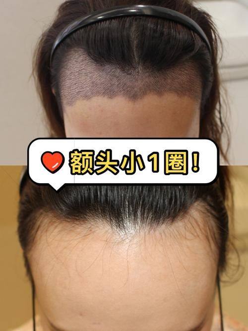 陈志芳医生技术优势：