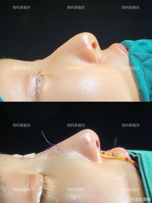 秦皇岛花惠医疗美容诊所预约挂号方式：