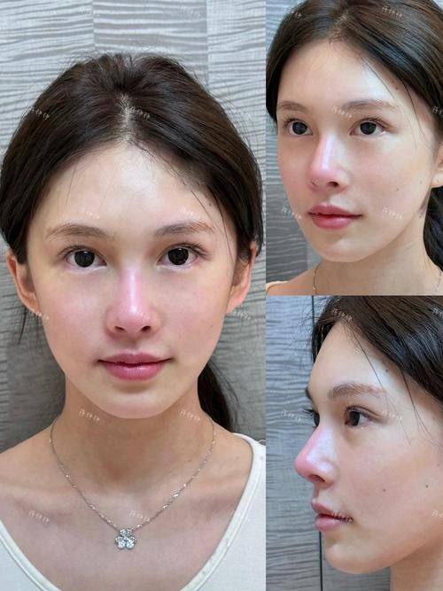 烟台韩美医疗美容诊所口碑评价：