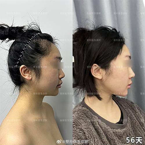 菏泽韩后医疗美容门诊部口碑评价