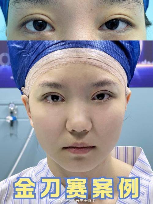 烟台韩美医疗美容诊所怎么样？