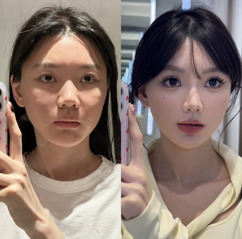 五、不同干预手段对疤痕肤色修复的影响