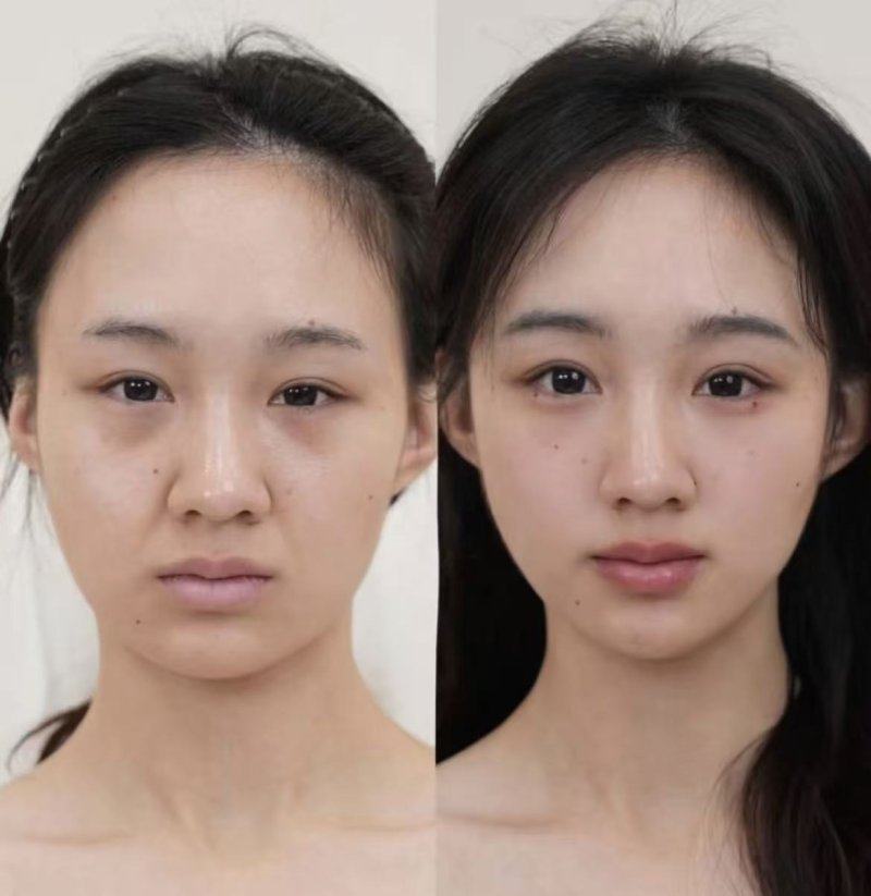 五、如何正确选择与使用修正去眼袋眼霜