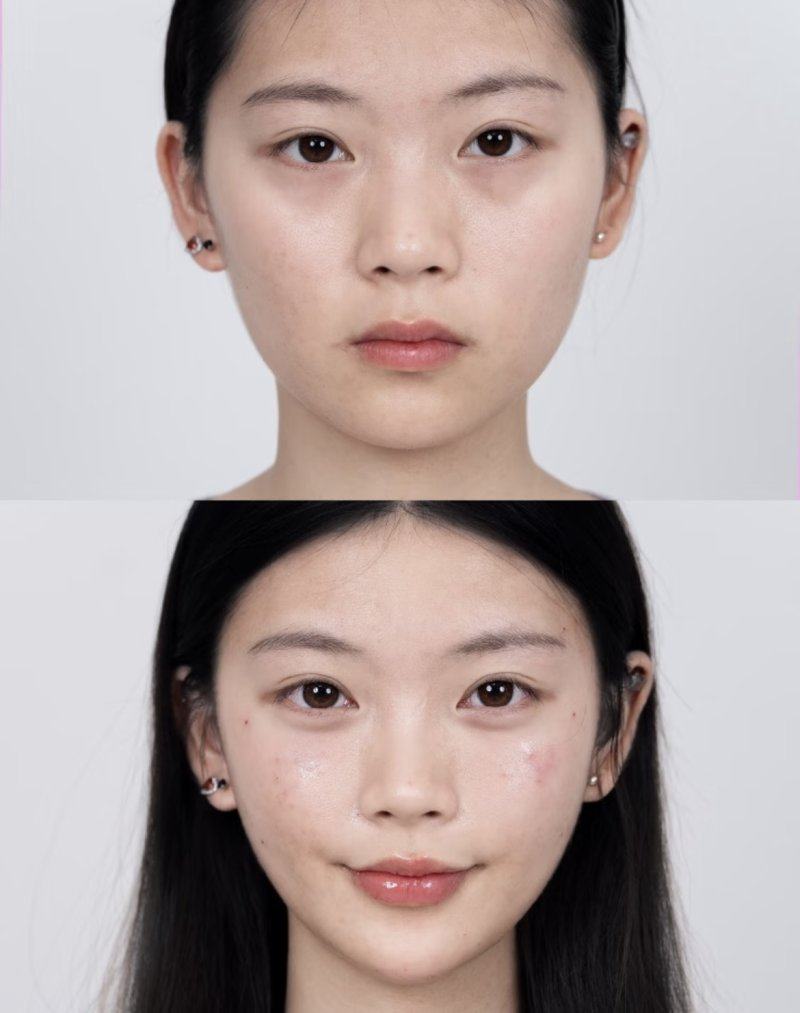 二、眼袋形成的根源是什么？为何眼霜无法起效？