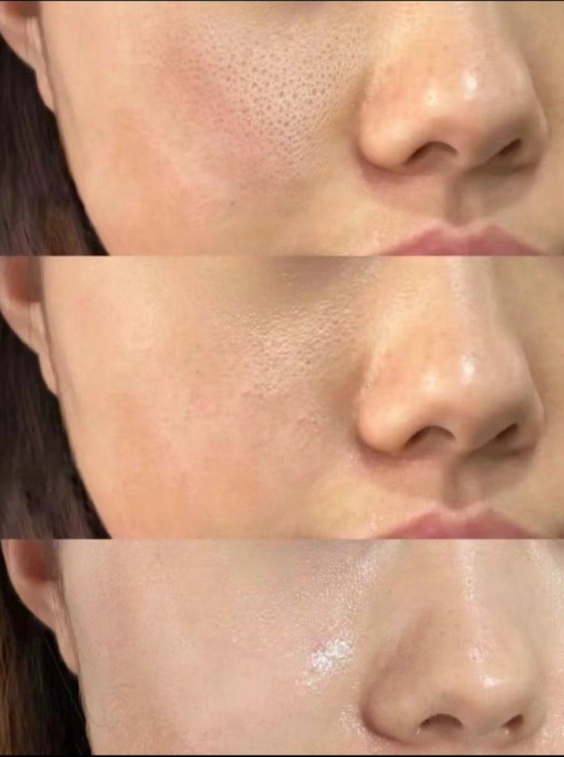 二、不同松弛程度的三角眼双眼皮设计方案