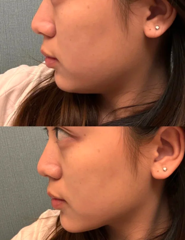 三、修正去眼袋眼霜的辅助作用：预防与干燥护理