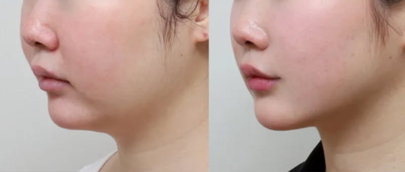 五、术后调味品选择参考指南