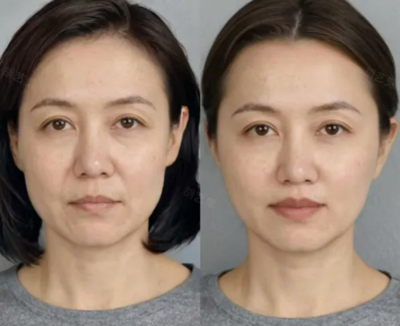 五、日常护理与医美结合的正确思路