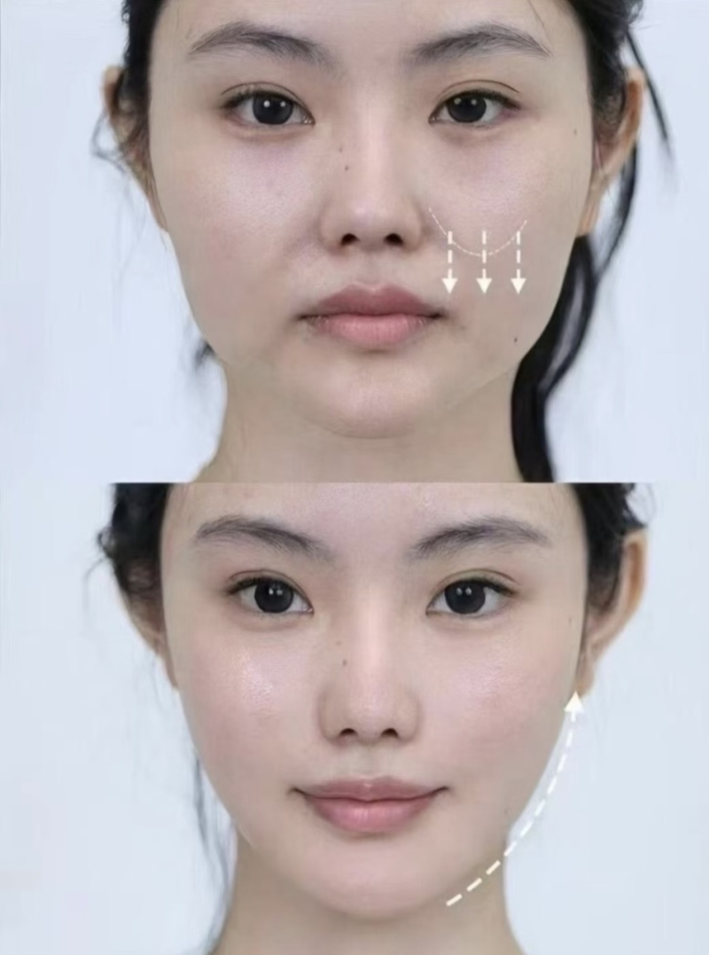 秦皇岛花惠医疗美容诊所擅长项目：