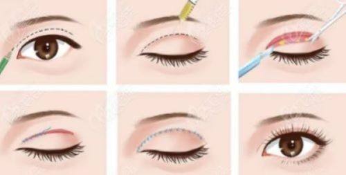 溧阳市中医院整形美容外科地址电话及营业时间