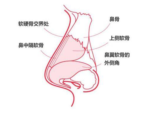 祛眼袋的核心注意事项