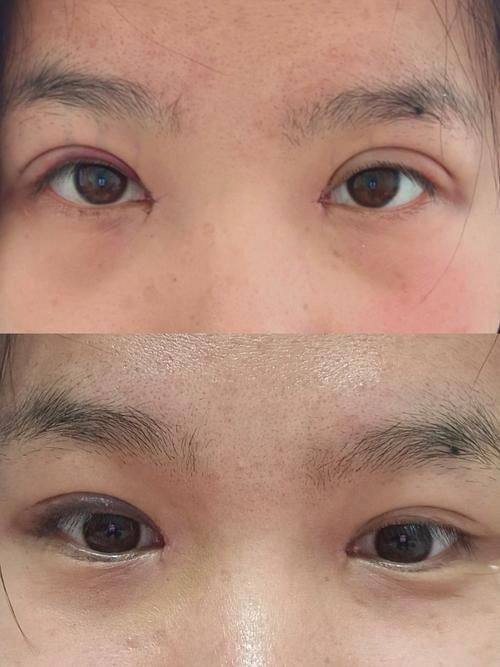 杨明勇医生口碑评价