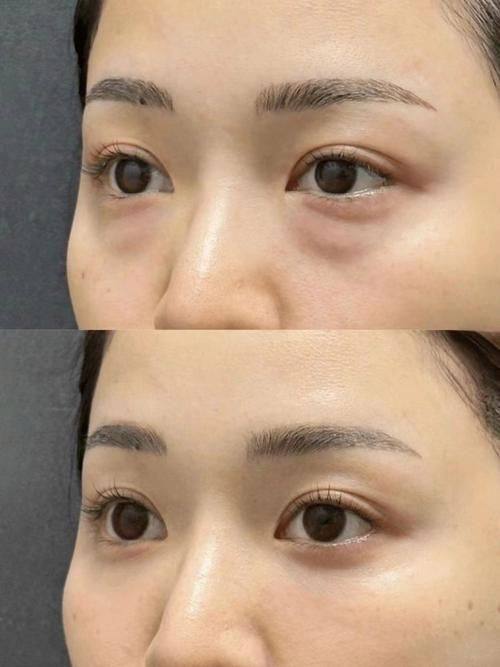 威海董立鹏星范整形医院擅长项目：