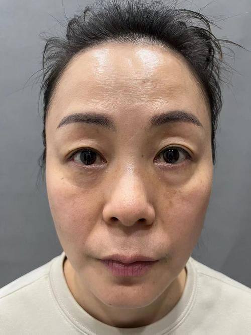 溧阳市中医院整形美容外科口碑评价