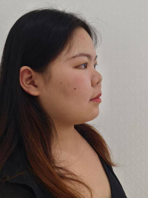 重庆美媛臣医疗美容门诊部预约挂号方式