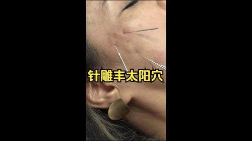 徐磊医生技术优势：