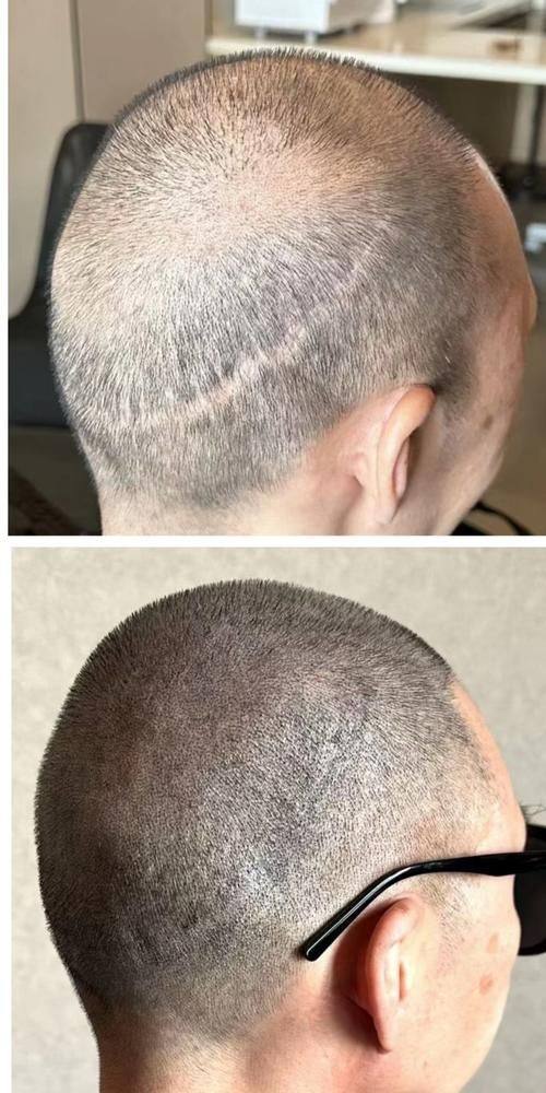 新乡仁爱妇产医院医学整形美容科口碑评价：