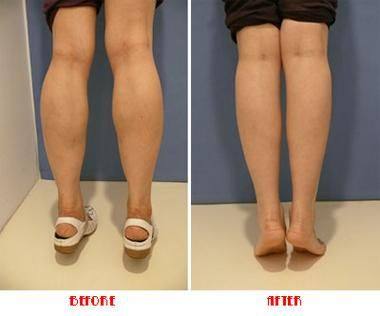 韩煜华医生技术优势