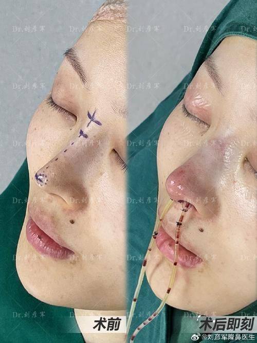 威海董立鹏星范整形医院价格表：