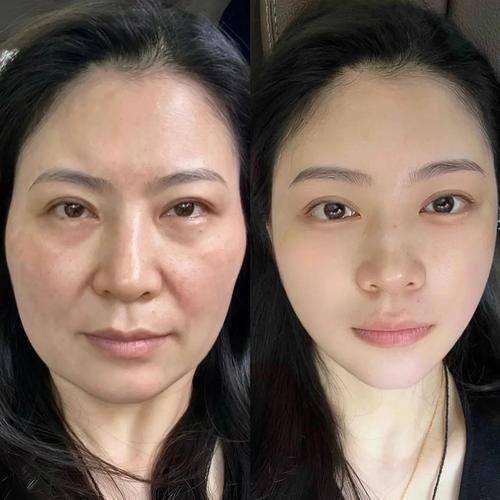 杨明勇医生技术优势