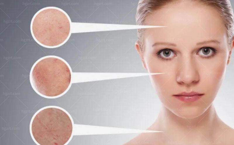 广州医美项目怎么选？鼻综合VS童颜针，鲁春医生给你方向