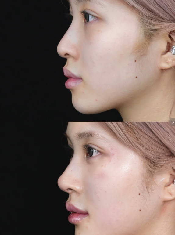 威海董立鹏星范整形医院口碑评价：