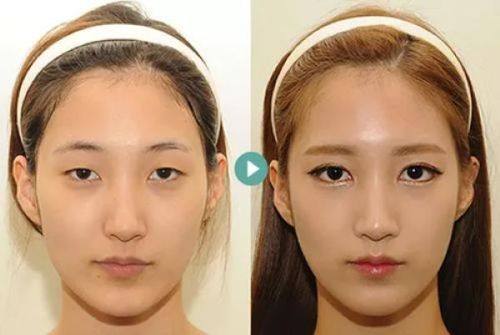 西安交通大学医学校第一附属医院烧伤整形美容科擅长项目：