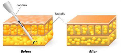 乌鲁木齐华茜医疗美容医院价格表：