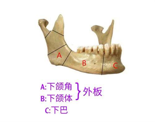 五、假体隆鼻搭配真皮垫的常见疑问解答