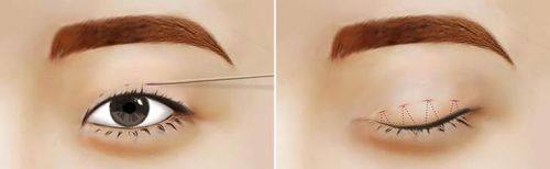 海恒林医生技术优势：