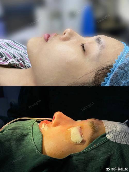 定州市人民医院烧伤整形美容科价格表：