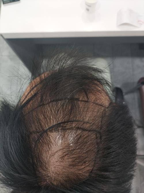 延安大学附属医院烧伤整形科怎么样？