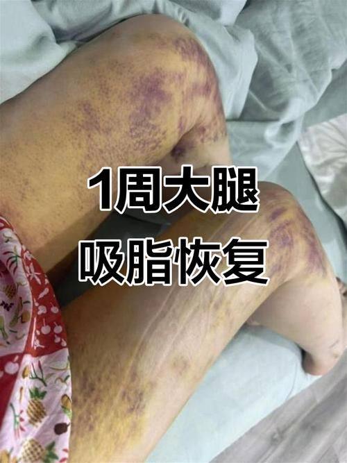 兴义泊悦科美医疗美容诊所怎么样？