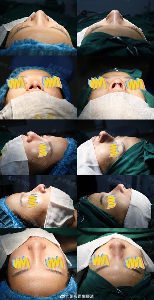 惠州查尔曼医疗美容门诊部地址电话及营业时间：