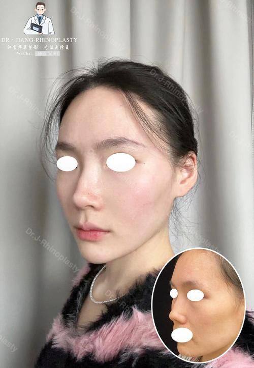 西安交通大学医学校第一附属医院烧伤整形美容科价格表：