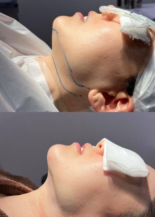 新疆乌鲁木齐金鹤整形医院擅长项目