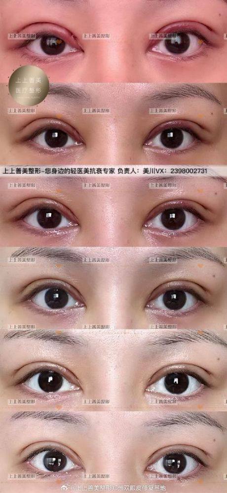 王佳琦医生怎么预约