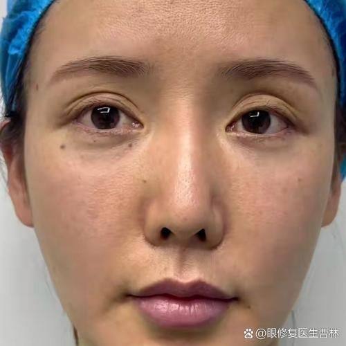 惠州查尔曼医疗美容门诊部擅长项目：