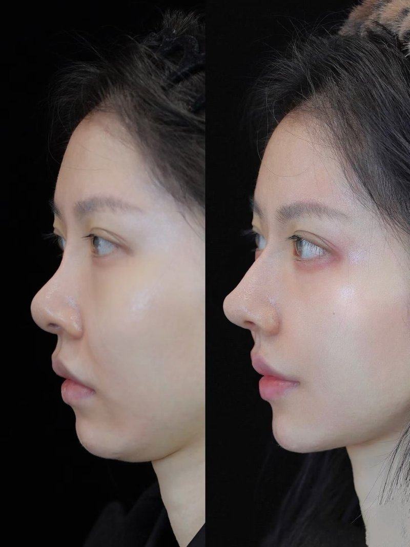 定州市人民医院烧伤整形美容科怎么样？