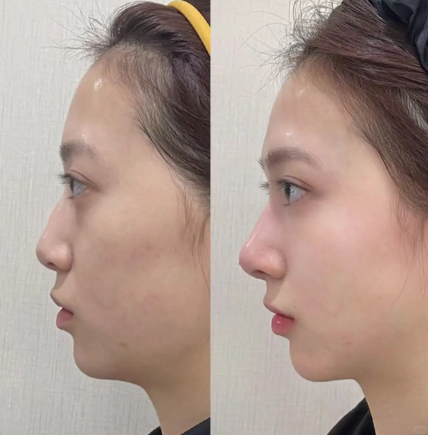 兴义泊悦科美医疗美容诊所价格表