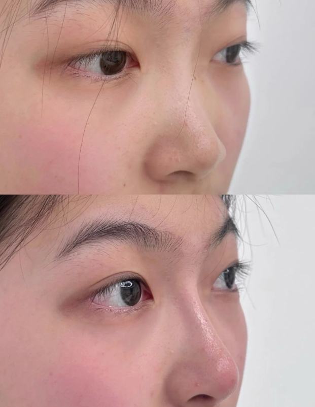 定州市人民医院烧伤整形美容科擅长项目：